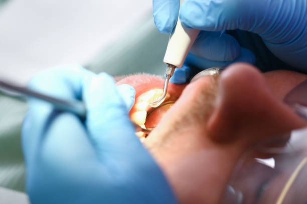 Best Pediatric Emergency Dentist in Milan, NM